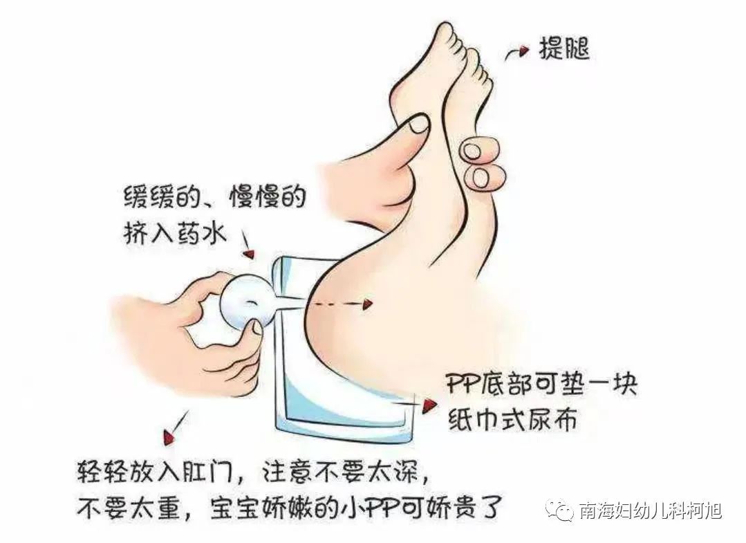 开塞露误用引发动脉血管破裂事故，警示家庭安全用药须知